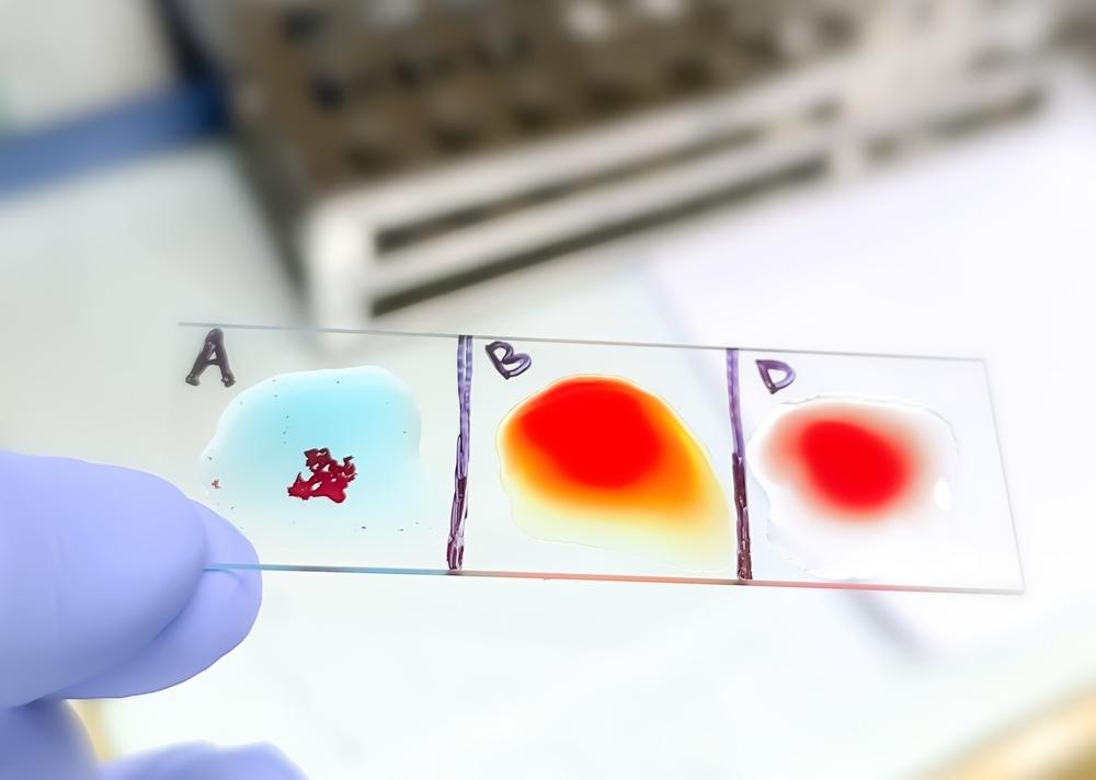 Sklíčko s kvapkami krvi pri teste krvných skupín A, B a D