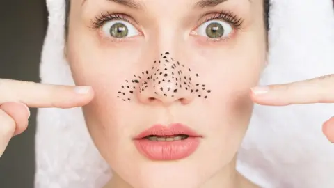 Detail nosa s čiernymi bodkami pred a po maske