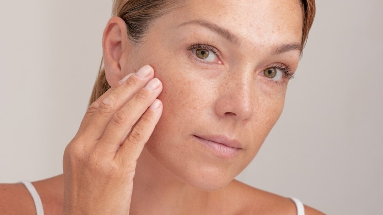 Žena s jemnými pigmentovými škvrnami nanáša prípravok na pleť
