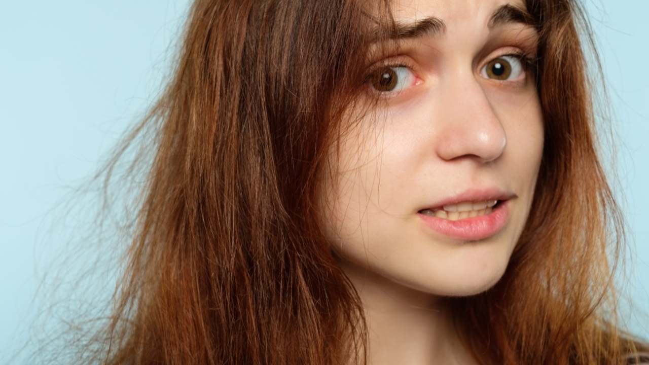 Žena s rozlietanými, krepovitými a elektrizujúcimi vlasmi počas zimy, nahnevaný výraz tváre.