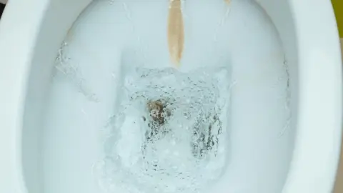 Detail znečistenej toalety s viditeľným vodným kameňom pred čistením.